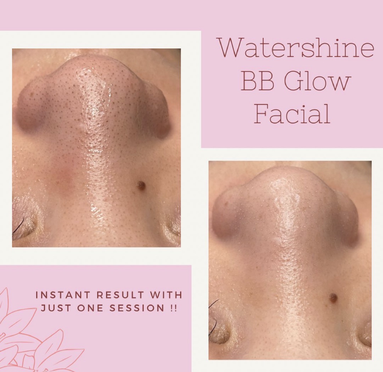 BB Glow facial 